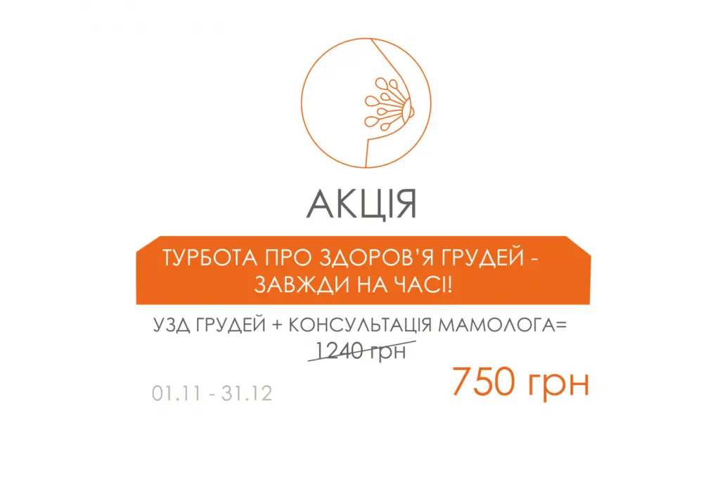 Попап-акція